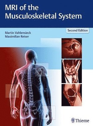 bokomslag MRI of the Musculoskeletal System