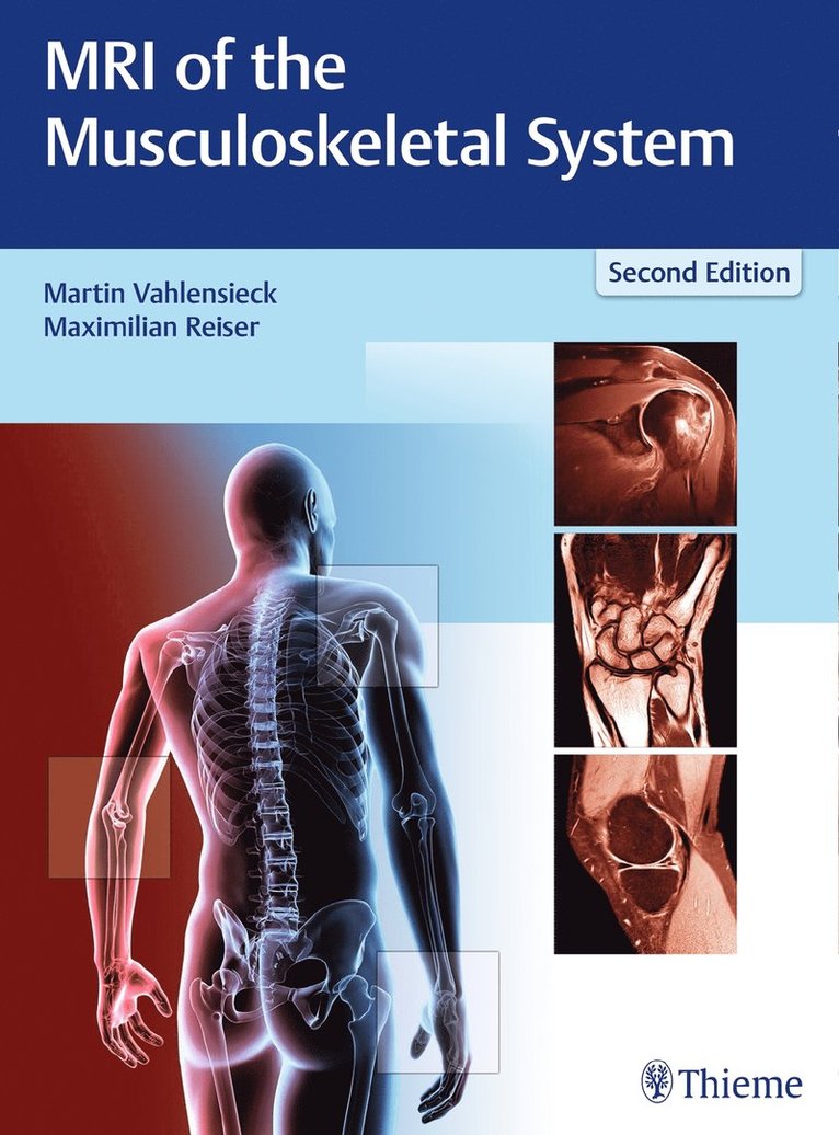 Martin Vahlensieck, Maximilian Reiser - MRI of the Musculoskeletal System, Inbunden