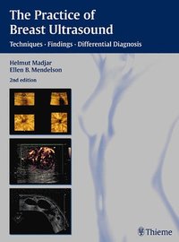 bokomslag The Practice of Breast Ultrasound: Techniques, Findings, Differential Diagnosis