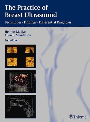 bokomslag Practice of Breast Ultrasound