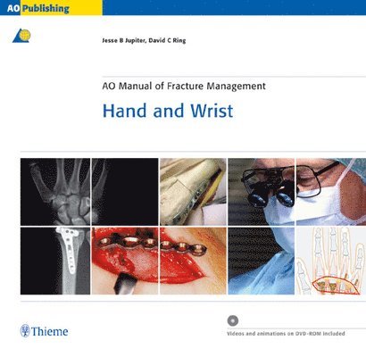 AO Manual of Fracture Management: Hand and Wrist, Book & DVD 1