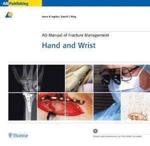 AO Manual of Fracture Management: Hand and Wrist, Book & DVD 1