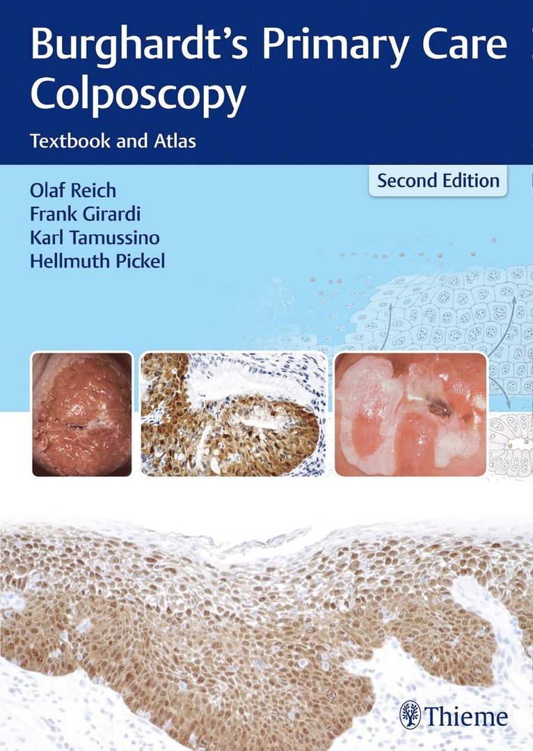 Olaf Reich, Frank Girardi, Karl Tamussino, Hellmuth Pickel - Burghardt's Primary Care Colposcopy, Häftad