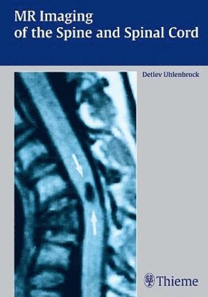 bokomslag MR Imaging of the Spine and Spinal Cord