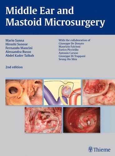 Hiroshi Sunose, Alessandra Russo, Abdelkader Taibah, Fernando Mancini, Mario Sanna - Middle Ear and Mastoid Microsurgery, Inbunden