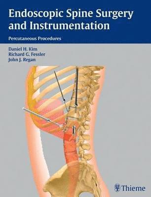 Daniel H. Kim, Richard Glenn Fessler, John Regan - Endoscopic Spine Surgery and Instrumentation, Inbunden
