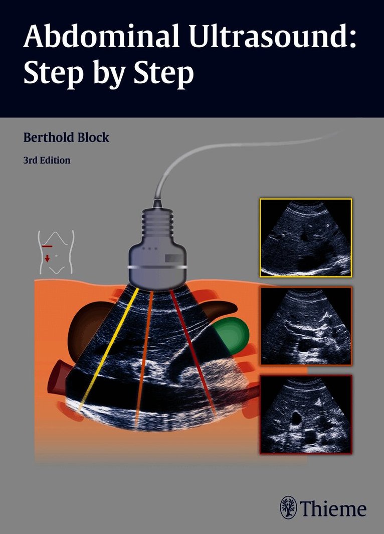 Abdominal Ultrasound: Step by Step