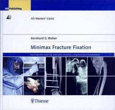 bokomslag Minimax Fracture Fixation: Case Collection: Lower leg - ankle joint - nonunions - autogenous bone transplantation