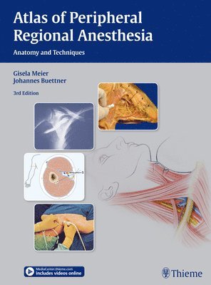 Atlas of Peripheral Regional Anesthesia 1