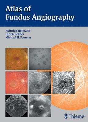 bokomslag Atlas of Fundus Angiography