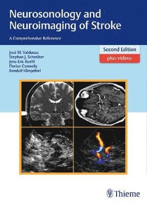 bokomslag Neurosonology and Neuroimaging of Stroke