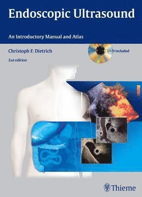 Endoscopic Ultrasound: An Introductory Manual & Atlas, Book/DVD Package 2nd Edition 1