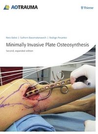 bokomslag Minimally Invasive Plate Osteosynthesis (MIPO)