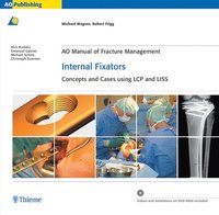 bokomslag AO Manual of Fracture Management: Internal Fixators: Concepts and Cases using LCP/LISS