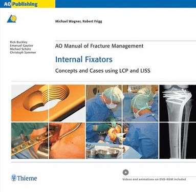 bokomslag AO Manual of Fracture Management: Internal Fixators: Concepts and Cases using LCP/LISS