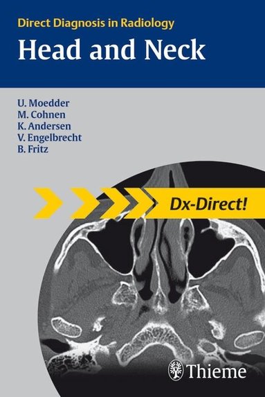Ulrich Moedder, Mathias Cohnen, Kjel Andersen, Volkher Engelbrecht, Benjamin Fritz - Head and Neck Imaging, Häftad