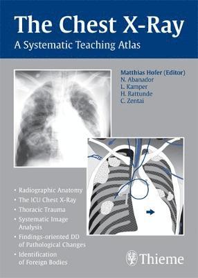 bokomslag The Chest X-Ray: A Systematic Teaching Atlas