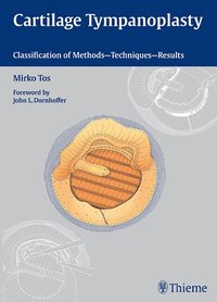 bokomslag Cartilage Tympanoplasty: Classification of Methods -- Techniques -- Results