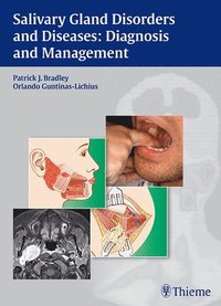 bokomslag Salivary Gland Disorders and Diseases: Diagnosis and Management