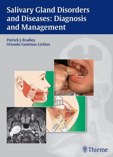 Patrick J. Bradley, Orlando Guntinas-Lichius - Salivary Gland Disorders and Diseases:, Inbunden