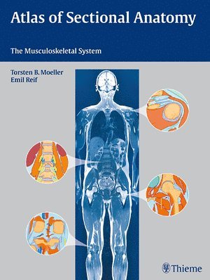 Atlas of Sectional Anatomy: The Musculoskeletal System 1