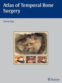 bokomslag Atlas of Temporal Bone Surgery