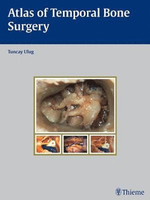 bokomslag Atlas of Temporal Bone Surgery