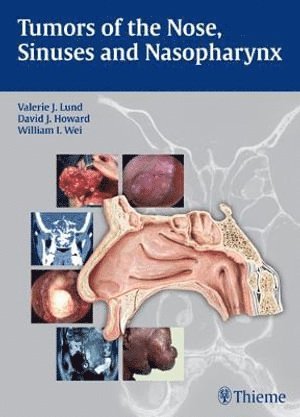 bokomslag Tumors of the Nose, Sinuses and Nasopharynx