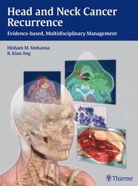bokomslag Head and Neck Cancer Recurrence: Evidence-based, Multidisciplinary Management