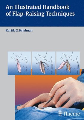 An Illustrated Handbook of Flap-Raising Techniques 1