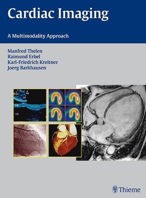Manfred Thelen, Raimund Erbel, Karl-Friedrich Kreitner, Jörg Barkhausen, Jorg Barkhausen - Cardiac Imaging, Inbunden