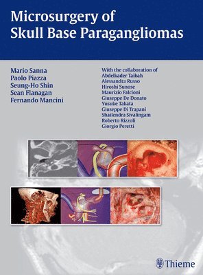 bokomslag Microsurgery of Skull Base Paragangliomas