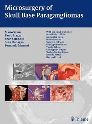 Mario Sanna, Paolo Piazza, Seung-Ho Shin, Sean Flanagan, Fernando Mancini - Microsurgery of Skull Base Paragangliomas, Inbunden