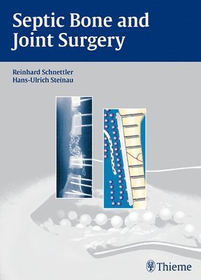 bokomslag Septic Bone and Joint Surgery
