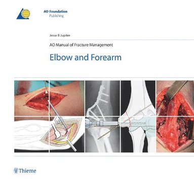 bokomslag AO Manual of Fracture Management - Elbow & Forearm