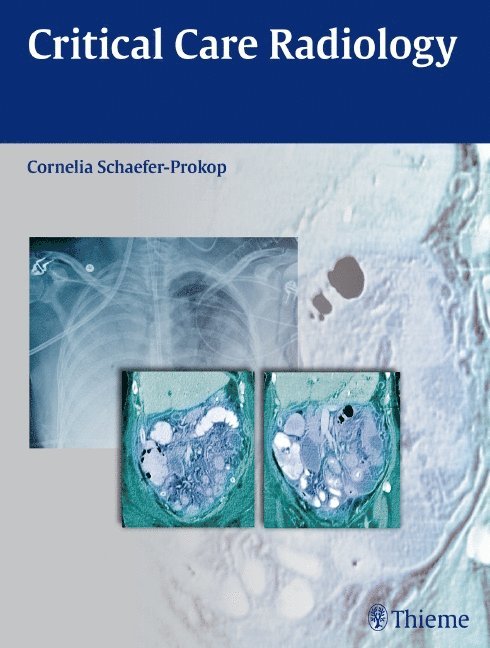 Cornelia Schaefer-Prokop - Critical Care Radiology, Inbunden