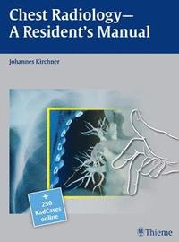 bokomslag Chest Radiology: A Resident's Manual