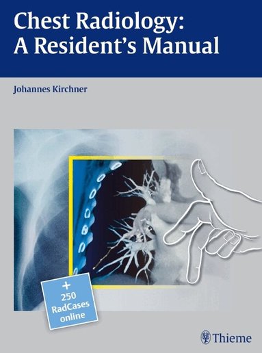 Johannes Kirchner - Chest Radiology: a Resident's Manual, Inbunden