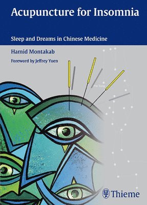 Acupuncture for Insomnia: Sleep and Dreams in Chinese Medicine 1