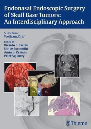 bokomslag Endonasal Endoscopic Surgery of Skull Base Tumors: An Interdisciplinary Approach