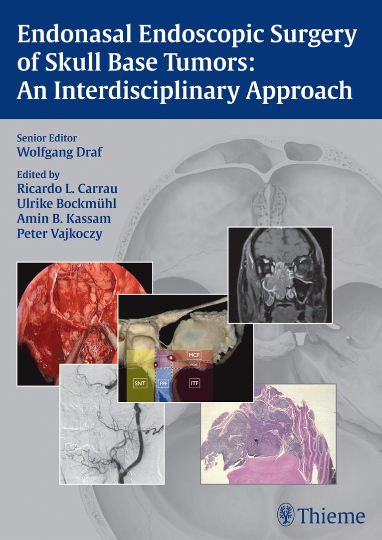 Wolfgang Draf, Ricardo L. Carrau, Ulrike Bockmühl, Amin B. Kassam, Peter Vajkoczy, Ulrike Bockmuhl - Endonasal Endoscopic Surgery of Skull Base Tumors: an Interdisciplinary Approach, Inbunden