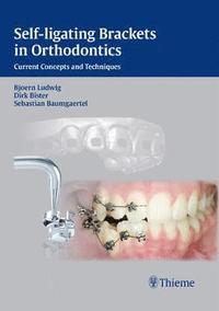 bokomslag Self-ligating Brackets in Orthodontics: Current Concepts and Techniques