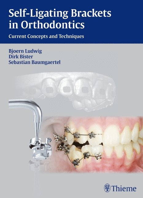 Björn Ludwig, Dirk Bister, Sebastian Baumgaertel, Bjorn Ludwig - Self-ligating Brackets in Orthodontics, Inbunden