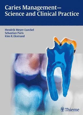bokomslag Caries Management - Science and Clinical Practice