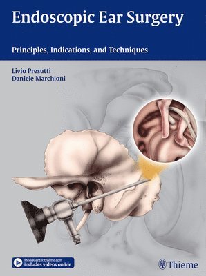 Endoscopic Ear Surgery 1