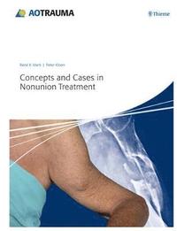 bokomslag Concepts and Cases in Nonunion Treatment