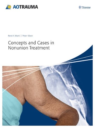 René K. Marti, Peter Kloen - Concepts and Cases in Nonunion Treatment, Inbunden