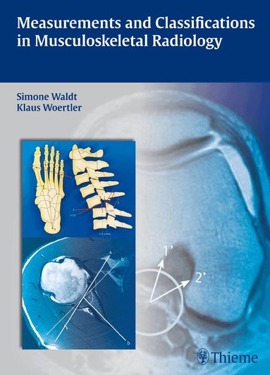 Simone Waldt, Klaus Wörtler - Measurements and Classifications in Musculoskeletal Radiology, Inbunden