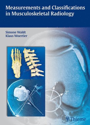 Simone Waldt, Klaus Wörtler, Klaus Wortler - Measurements and Classifications in Musculoskeletal Radiology, Inbunden