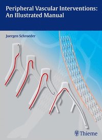 bokomslag Peripheral Vascular Interventions: an Illustrated Manual